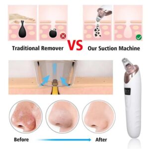 face vacuum suction blackhead remover